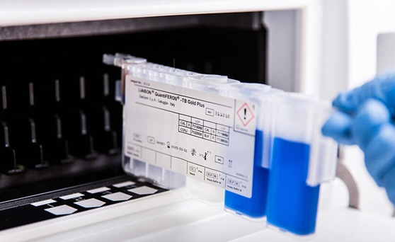 Image: The fully automated workflow builds on growing adoption of LIAISON QuantiFERON‑TB Gold Plus II (photo courtesy of Diasorin)