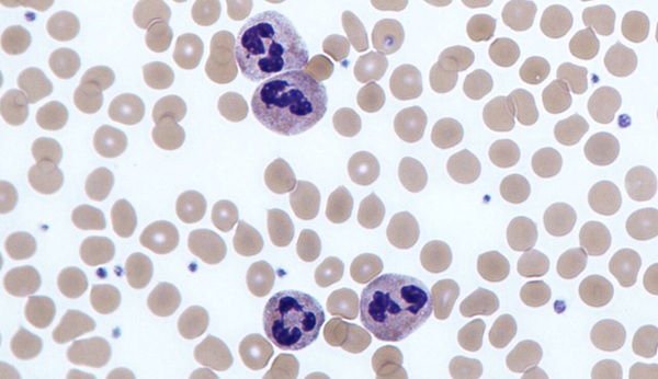 Image: Investigators identify neutrophils as a newly recognized source of C4A, a protein genetically linked to schizophrenia (Photo courtesy of Dr Graham Beards/Wikimedia Commons, CC BY-SA 3.0)