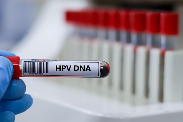 Image: By directly measuring circulating tumor-derived HPV DNA, the assay aims to identify postsurgical patients with persistent disease who may benefit from additional treatment (Image credit: iStock)
