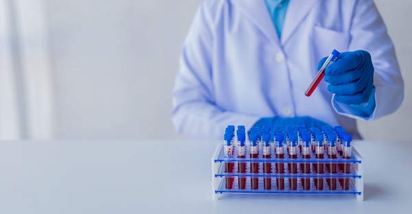 Image: The partnership aims to broaden access to ultrasensitive blood-based testing for multiple myeloma and other hematologic malignancies (Image credit: 123RF)