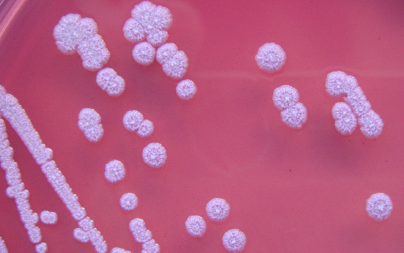 Image: Burkholderia pseudomallei is a soil-dwelling bacterium that causes melioidosis, a severe and potentially fatal infection that remains difficult to diagnose (Image Credit: Gavin Koh/Wikimedia Commons, CC BY-SA 4.0)
