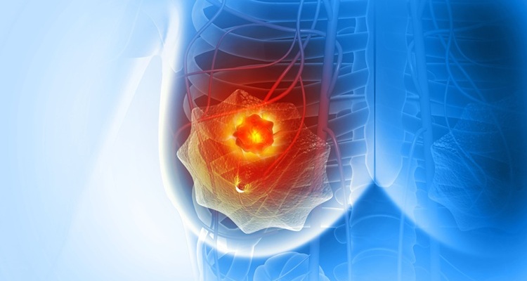 Image: The findings represent an important precision oncology milestone, independently confirming that endocrine activity in HR+/HER2− breast tumors can predict sensitivity to specific chemotherapy approaches (Image Credit: Adobe Stock)