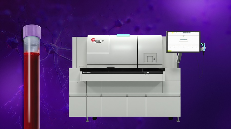 Image: Access p-Tau217 is a blood test designed to support amyloid pathology evaluation in patients with cognitive decline (Photo courtesy of Beckman Coulter)