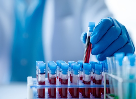 Image: The findings highlight the potential of blood-based immune profiling to provide a more comprehensive picture of how patients respond to immunotherapy. (Image Credit: Adobe Stock)
