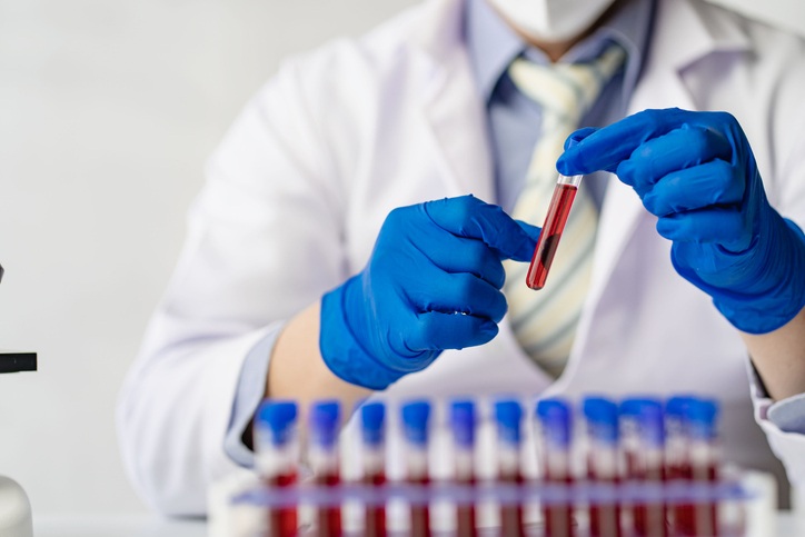 Image: New findings show that measuring a broader panel of blood proteins can improve Alzheimer\'s disease staging (Image Credit: iStock)