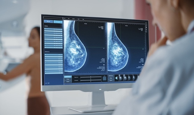 Image: The findings indicate that blood screening for women with dense breasts could improve lifetime health outcomes at lower healthcare cost than mammography alone. (Image Credit: Adobe Stock)