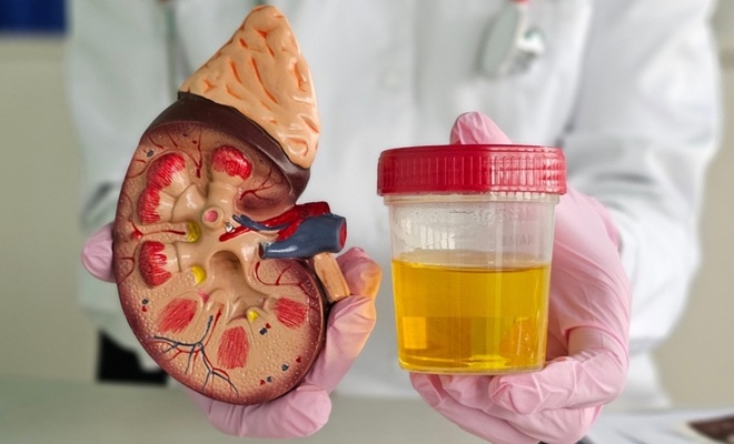 Image: The approach combines biomarker signals from donor kidney urine with the KDPI to estimate the likelihood of favorable long-term function (Image Credit: Shutterstock)