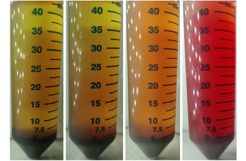 Image: The “broth” used to monitor red blood cell depletion in whole blood spiked with one colony-forming-unit of E. coli bacteria, each incubated at different orbital shaking speeds—left to right: 0 RPM, 65 RPM, 120 RPM and 200 RPM—after four hours of incubation. This culturing raises a bacteria-rich, plasma-like layer of bacteria to the top of the vials, while clusters of stuck blood cells known as a Rouleaux formation sink to the bottom. (Image Credit: Pak Kin Wong)