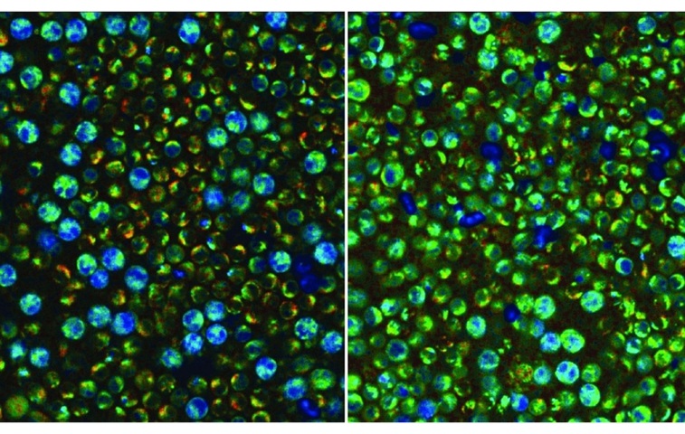 Image: Metabolically quiescent (left) and activated (right) peripheral blood mononuclear cells captured with optical metabolic imaging. (Image Credit: Skala Lab / Jeremiah Riendeau)