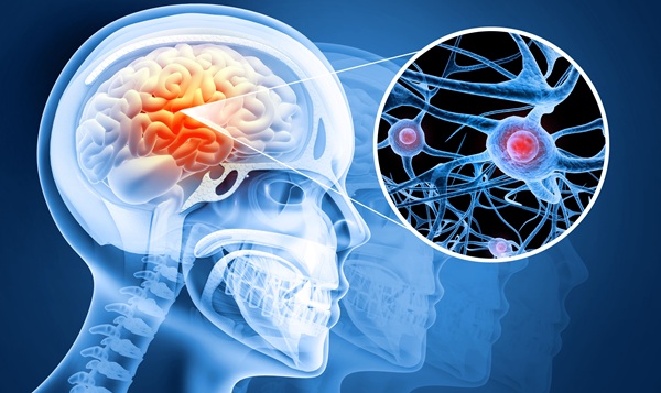 Image: Researchers identified a naturally occurring brain-related antibody linked to lower depression and PTSD symptoms after TBI (Image Credit: Adobe Stock)