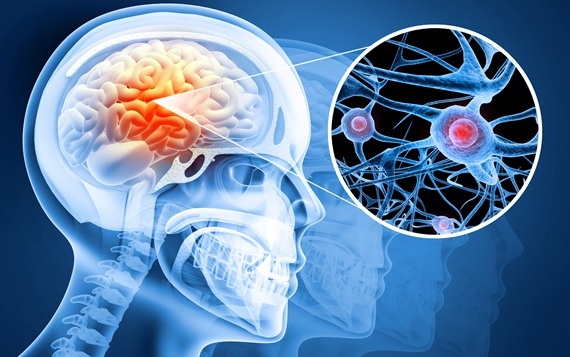 Image: Researchers identified a naturally occurring brain-related antibody linked to lower depression and PTSD symptoms after TBI (Image Credit: Adobe Stock)