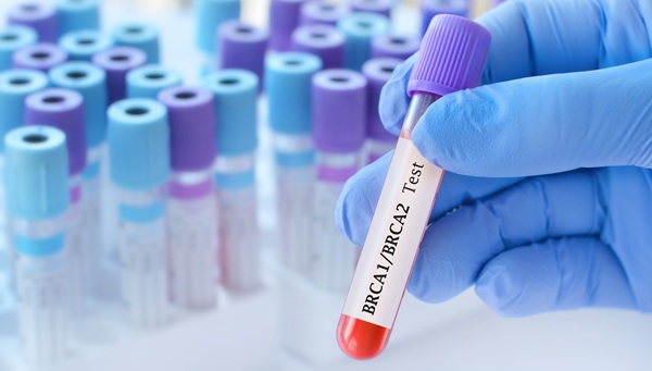 Image: Personalized support increased BRCA testing uptake among at-risk relatives from 51% to 73% at six months, reaching 90% by 18 months (Image Credit: Adobe Stock)