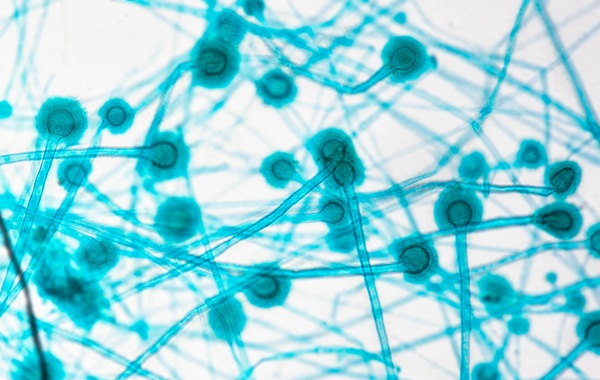 Image: Invasive aspergillosis (IA) is a potentially life-threatening infection caused by Aspergillus mold that primarily affects people with severely weakened immune systems. (Image Credit: Adobe Stock)