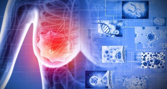 Image: The AidaBREAST assay integrates multimodal data to provide patient-specific 10-year recurrence risk and individualized predictions of radiation therapy benefit (photo courtesy of PreludeDx)