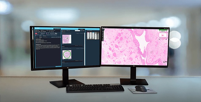 Image: Fujifilm announced the launch of Synapse Pathology v3.0 as a major software upgrade of its digital pathology platform, introducing over 50 new features, AI orchestration capabilities, and the Synapse Pathology AI Foundation model. (Photo courtesy of FUJIFILM Healthcare Americas Corporatio)