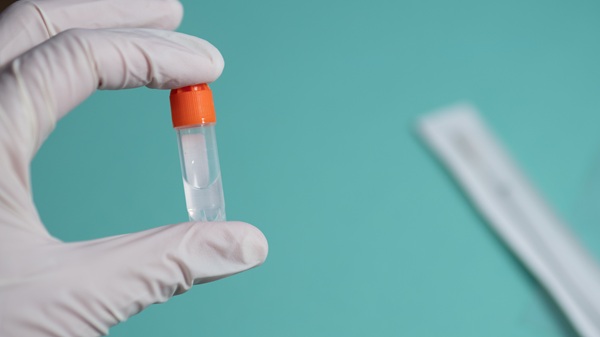 Image: The study analyzed saliva samples from people undergoing treatment for OCD (Image Credit: Adobe Stock)