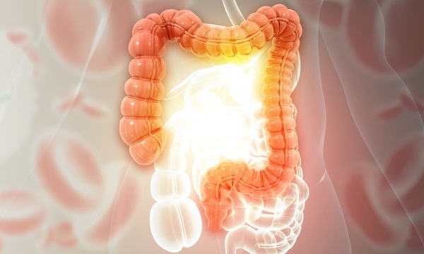 Image Credit: iStock