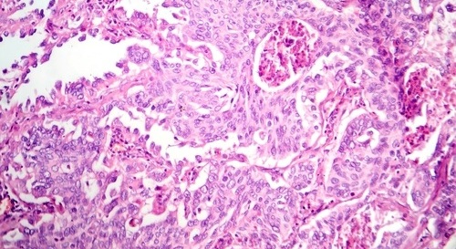 Image: The AI-enabled panel analyzes routine H&E whole-slide images to predict clinically relevant genomic and IHC biomarker status, supporting more timely access to personalized therapies. (Image Credit: Shutterstock)