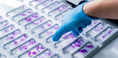 Image: The CE-marked software IVD combines digital histopathology and clinicopathological data to generate a prognostic classification (Image Credit: Shutterstock)