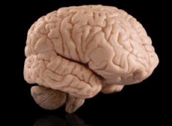 BigBrain: An Ultrahigh-Resolution 3D Human Brain Model