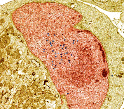 Image: Colored transmission electron micrograph (TEM) of a section through the nucleus (orange) of a cancerous white blood cell, showing several Epstein-Barr virus particles (blue). (Photo courtesy of Steve Gschmeissner / SPL).