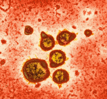 Image: Colored transmission electron micrograph (TEM) of respiratory syncytial virus (RSV), a major cause of respiratory tract infections (Photo courtesy of Hazel Appleton, Center for Infections / Health Protection Agency / SPL).