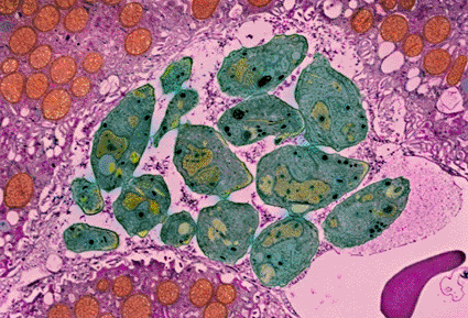 Image: Colored transmission electron micrograph (TEM) of Toxoplasma gondii parasites (green), the cause of toxoplasmosis (Photo courtesy of Moredun Scientific Ltd / SPL).
