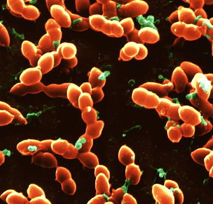 Image: Colored scanning electron micrograph (SEM) of clusters of the bacteria <i>Streptococcus pneumoniae</i> (Photo courtesy of the Eye of Science).