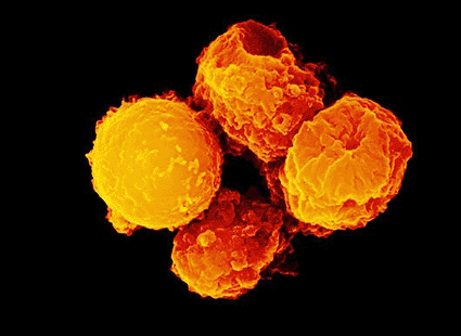 Image: Color-enhanced scanning electron micrograph (SEM) of apoptosis or “programmed cell death” (Photo courtesy of Stem Jems).
