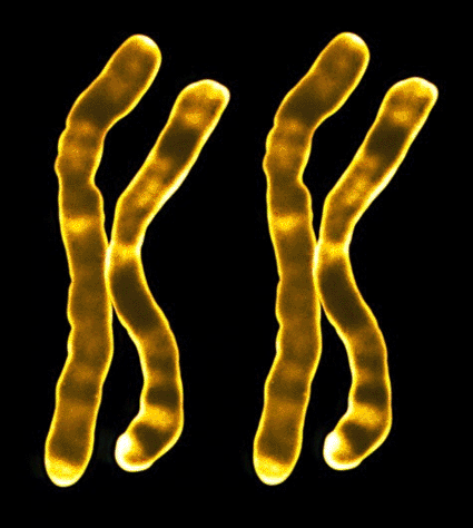 Image: Colored light micrograph of the two X chromosomes of a human female (Photo courtesy of the Department of Clinical Cytogenetics, Addenbrookes Hospital).
