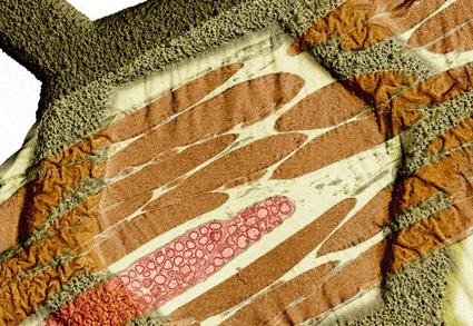 Image: Colored scanning electron micrograph (SEM) of an ultrathin section of tissue containing muscle (brown) and nerves (pink) supported on a transmission electron micrograph (TEM) octagonal grid (Photo courtesy of Steve Gschmeissner / SPL).