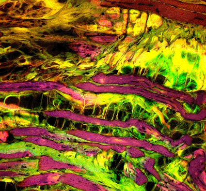 Image: Confocal light micrograph images of a section through muscle tissue affected by muscular dystrophy, a genetic disorder typified by muscle wasting and loss of function (Photo courtesy of Patrick Landmann).