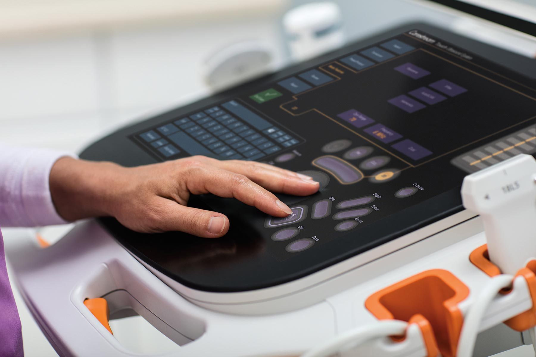 Carestream Touch Ultrasound System