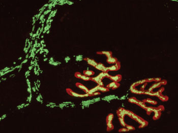 Image: The micrograph shows a peripheral nerve, with the neuromuscular endplates stained in red. The nerve-cell mitochondria were imaged with a fluorescent redox sensor (green in the cytoplasm, yellow at the endplates) (Photo courtesy of M. Kerschensteiner and T. Misgeld).