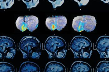 Image: A series of three MRI images (top row) shows how dopamine concentrations change over time in the brain’s ventral striatum (Photo collage courtesy of Christine Daniloff/MIT, with images courtesy of the MIT researchers).