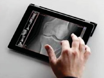 Image: The dicomPACSMobileView 1.6 mobile freedom image viewer (Photo courtesy of OR Technology).