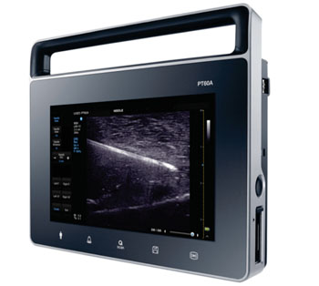 Image: Samsung’s PT60A tablet-based, ultrasound system provides wireless transmission of ultrasound images (Photo courtesy of Samsung).
