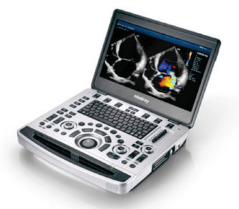 Image: The M9 multipurpose ultrasound portable ultrasound system (Photo courtesy of Mindray).