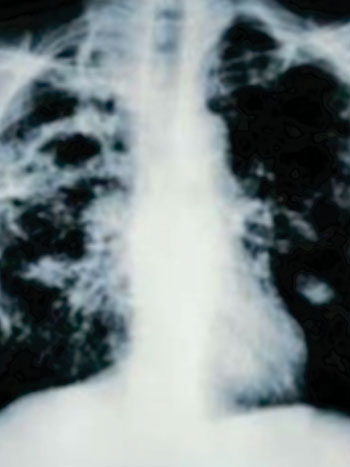 Image: An image from a CT scan (Photo courtesy of Consumer Reports).