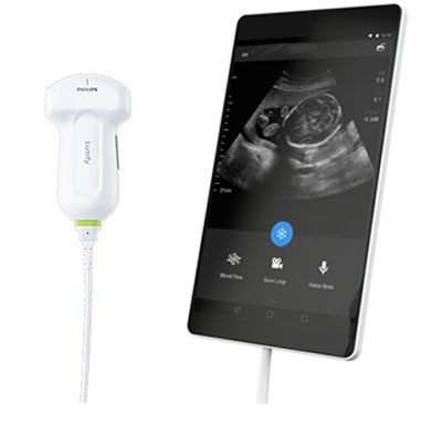 Image: The Lumify, app-based ultrasound system (Photo courtesy of Philips).