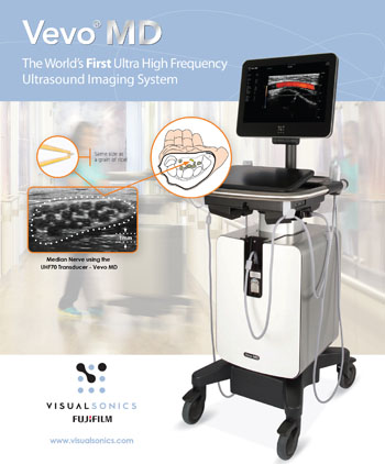 Image: Vevo MD, the world’s first ultra-high-frequency ultrasound imaging systems (Photo courtesy of FUJIFILM VisualSonics).