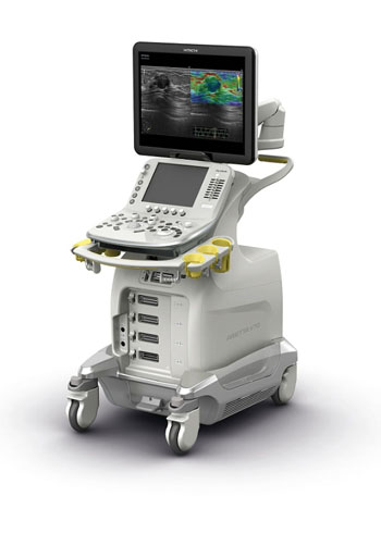 Image: The ARIETTA V70 with enhanced Elastography functions (Photo courtesy of Hitachi Medical Systems).