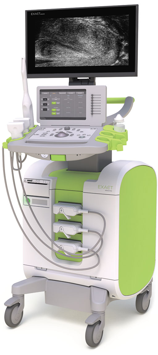 Image: The ExactVu Micro-ultrasound system (Photo courtesy of Exact Imaging).