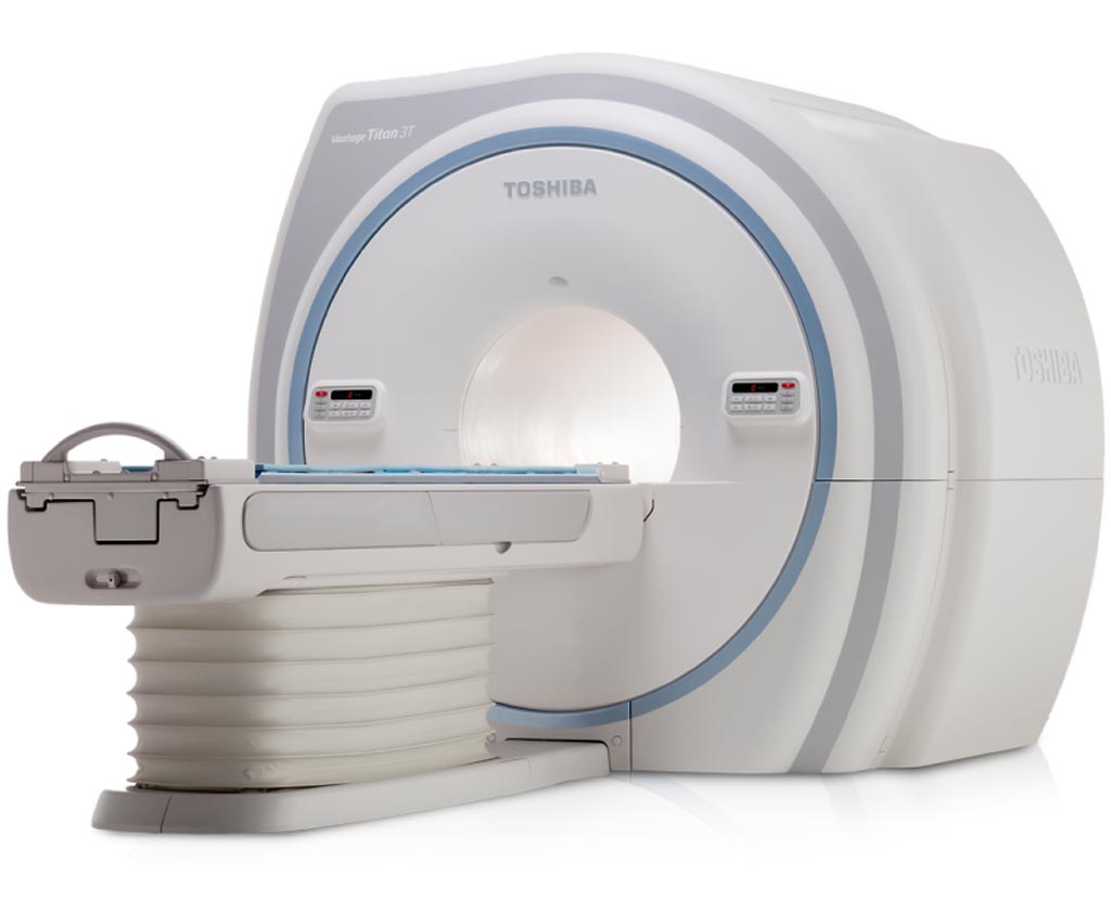 Image: The Vantage Titan 3T MRI system (Photo courtesy of Toshiba Medical Systems).