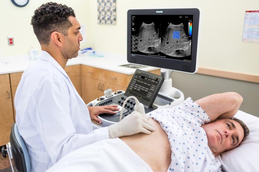 Image: Liver disease assessment using the ultrasound ElastQ Imaging SWE functionality is faster and than a tissue biopsy, and noninvasive (Photo courtesy of Philips Healthcare).