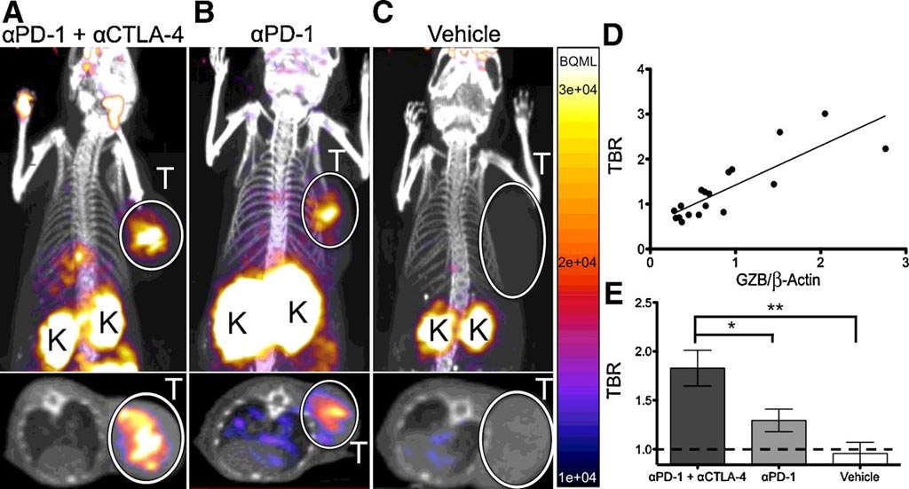 Image: A new non-invasive PET imaging technique can help clinicians predict immunotherapy response earlier (Photo courtesy of AACR Journals).