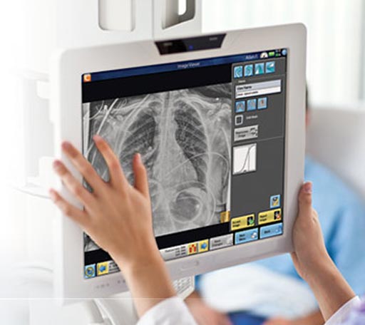 Image: The DirectView DR and CR software (Photo courtesy of Carestream Health).
