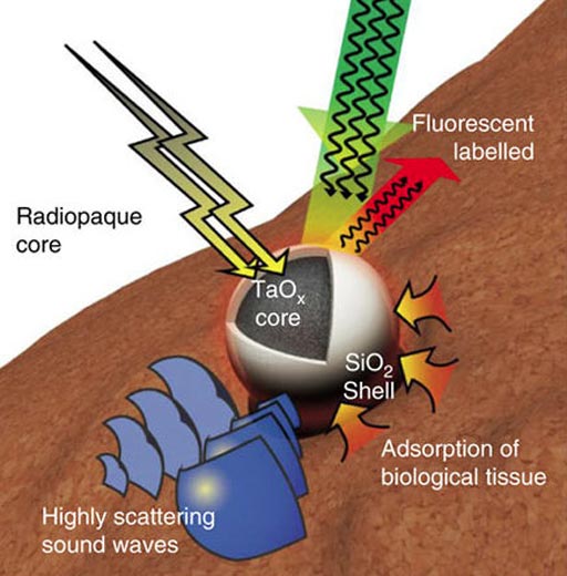 Image: An illustration of a multifunctional Tantalum oxide/silica core/shell nanoparticles (TSNs) with a radiopaque core for X-ray imaging, conjugated fluorescent dye for fluorescent imaging, a dense core material with a high sound-scattering effect for ultrasound imaging, and a silica surface for adhesive property (Photo courtesy of Nature Communications).