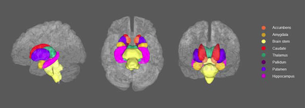 Image: Subcortical structures of interest in left, inferior and anterior view (Photo courtesy of Whalley et al./Scientific Reports).