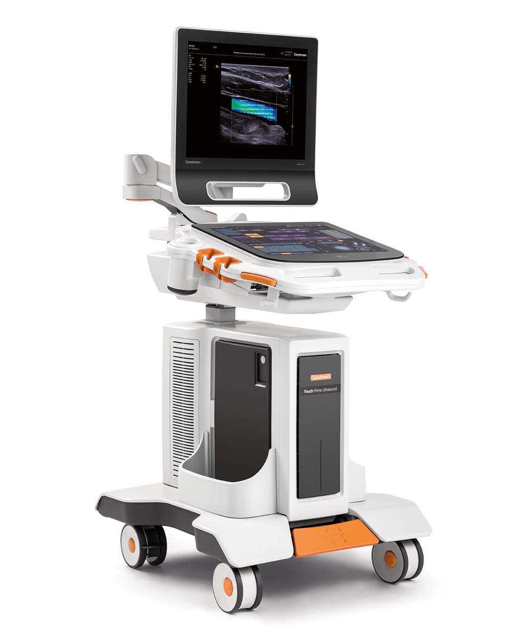 Image: The Touch Prime XE ultrasound system (Photo courtesy of Carestream Health).